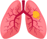 Lung