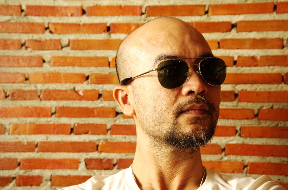 Losing Your Head? Don't – Hair Loss Is Managable Losing Your Head? Don't – Hair Loss Is Managable